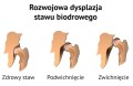 Odwodząca poduszka FREJKI AM-SB-07   -   4KIDS.jpg