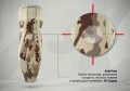 Anatomiczna orteza łokcia i przedramienia 4ARMY-SL-02 - REH4MAT.jpg