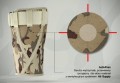 Anatomiczna orteza uda 4ARMY-U-01  - REH4MAT.jpg