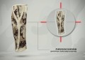 Anatomiczna orteza podudzia 4ARMY-PU-01  -  REH4MAT.jpg