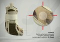 Orteza stawu skokowego z łuskami anatomicznymi 4ARMY-SS-02  - REH4MAT.jpg