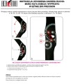 Instrukcja regulacji szyny 2RA Precision.jpg