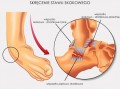 Anatomiczna orteza stawu skokowego AM-SX-08 -  4MEDIC.jpg
